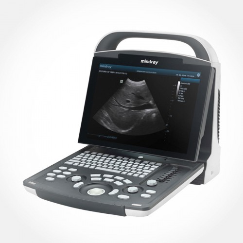 DP-20 Ultrasound System